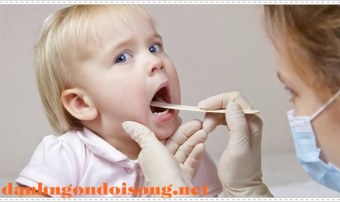 Viêm mũi họng cấp là gì? Cách chữa viêm mũi họng cấp